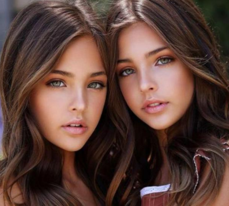 What the world’s most beautiful twins look like now – JiZNoDnA